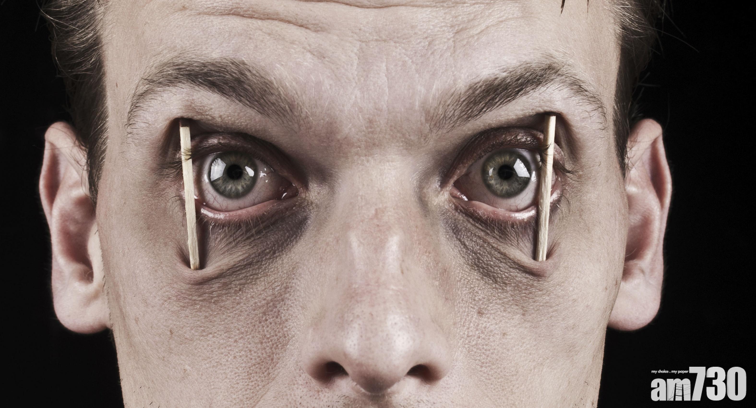 【失眠最弊】唔夠瞓積聚Tau蛋白 易患阿茲海默氏症