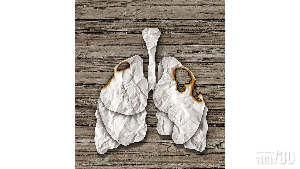 肺癌適切治療次序 提升存活率