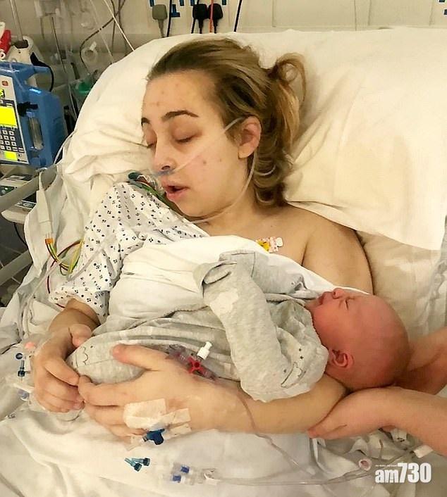 雙子宮懷孕零徵狀  少女瞓醒變嫩媽