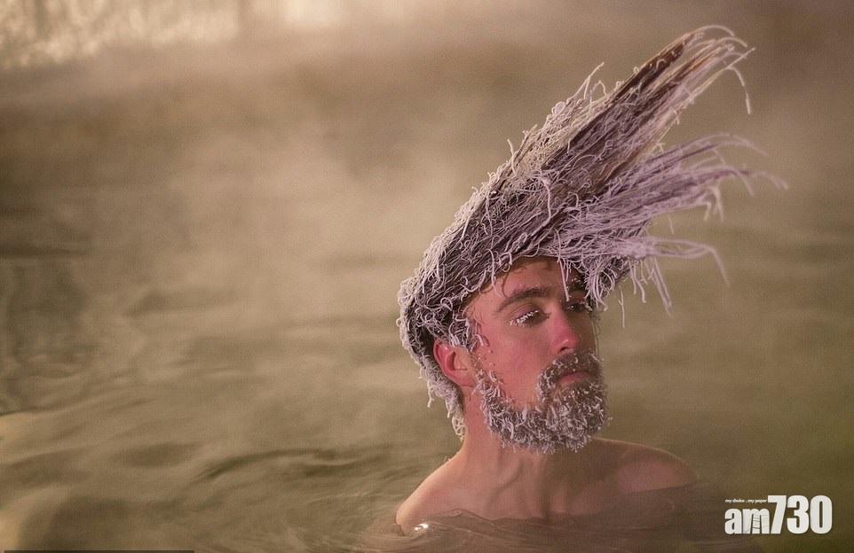 一熱一寒 冰髮衝冠selfie賽