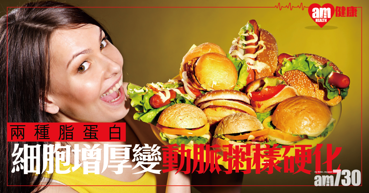 【高脂飲食】兩種脂蛋白 細胞增厚變動脈粥樣硬化