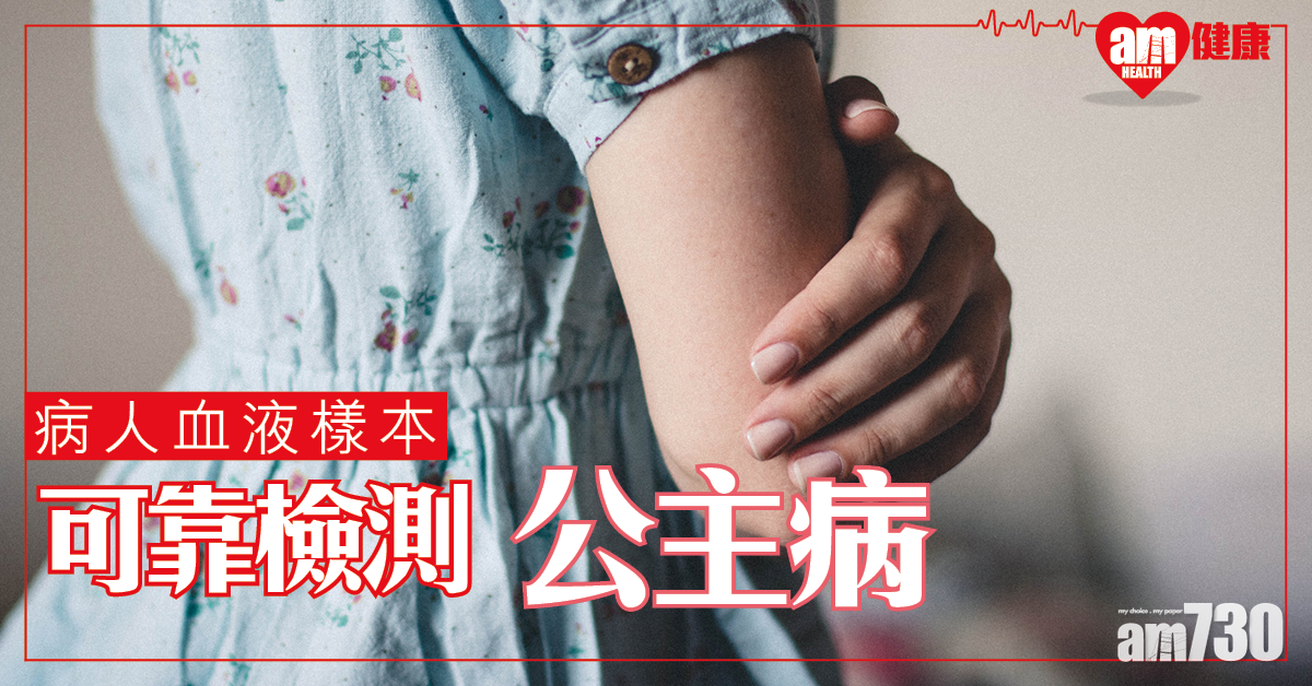 【準確檢測】從病人血液樣本 可靠驗出「公主病」
