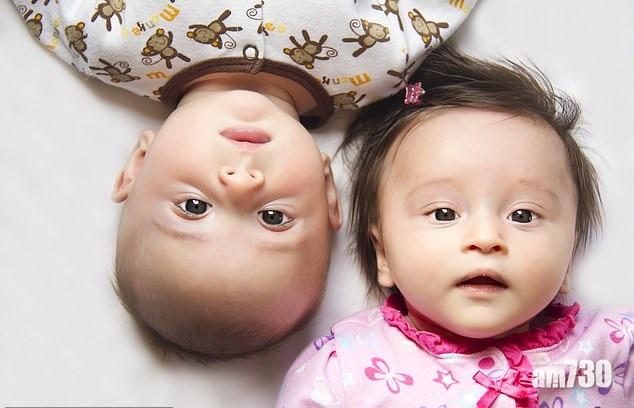 龍鳳胎囡囡 先天所致較運滯 