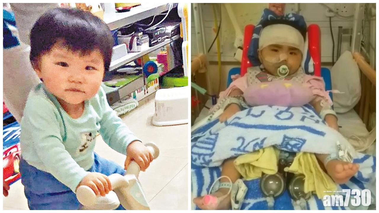 小智愷大腦及腎功能改善 主診醫生指換心好時機