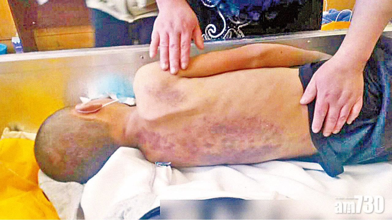 9歲私校男童疑受虐病死 吉林官方：僅延誤治療