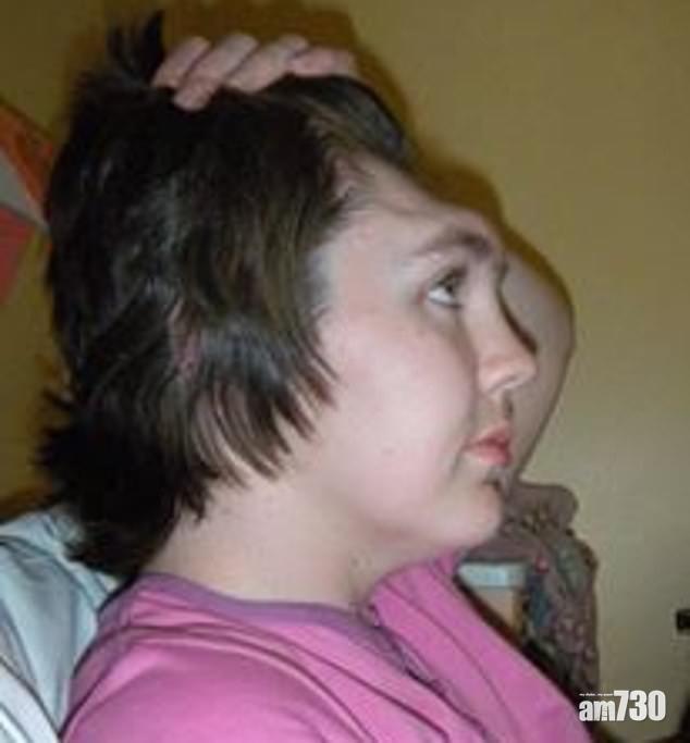 【不要亂坐】腳放車頭儀表板  女乘客膝蓋撞頭凹額毀容