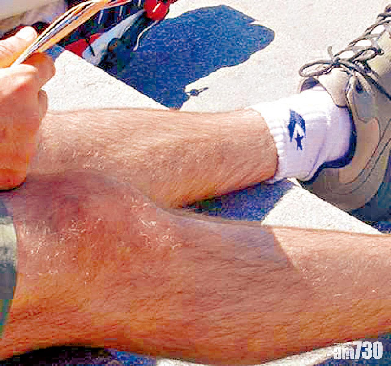 日調查：九成女生 討厭男友有體毛