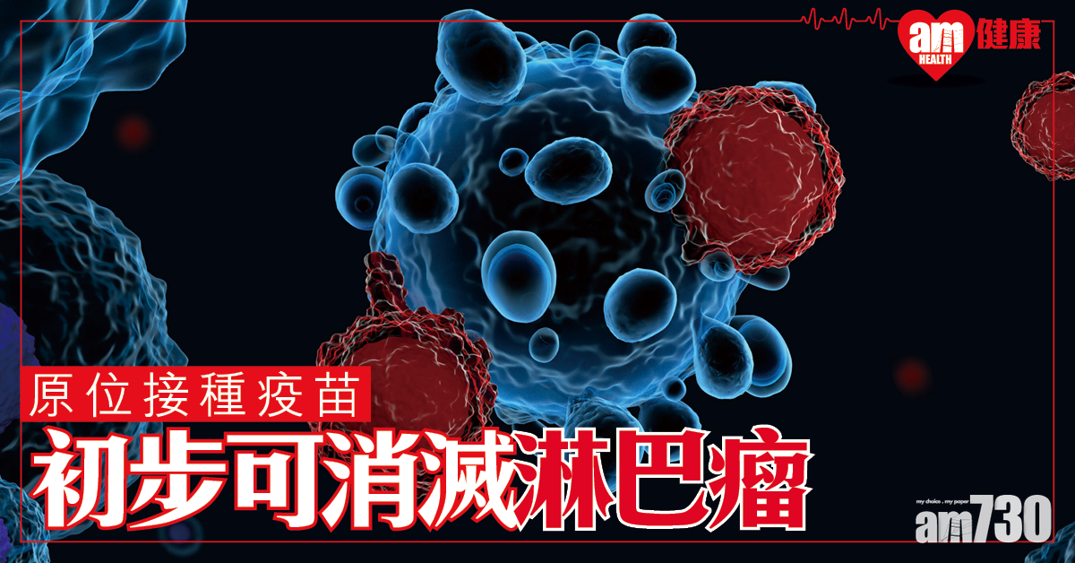 【抗癌新突破】臨床結果：原位接種疫苗 初步可消滅淋巴瘤