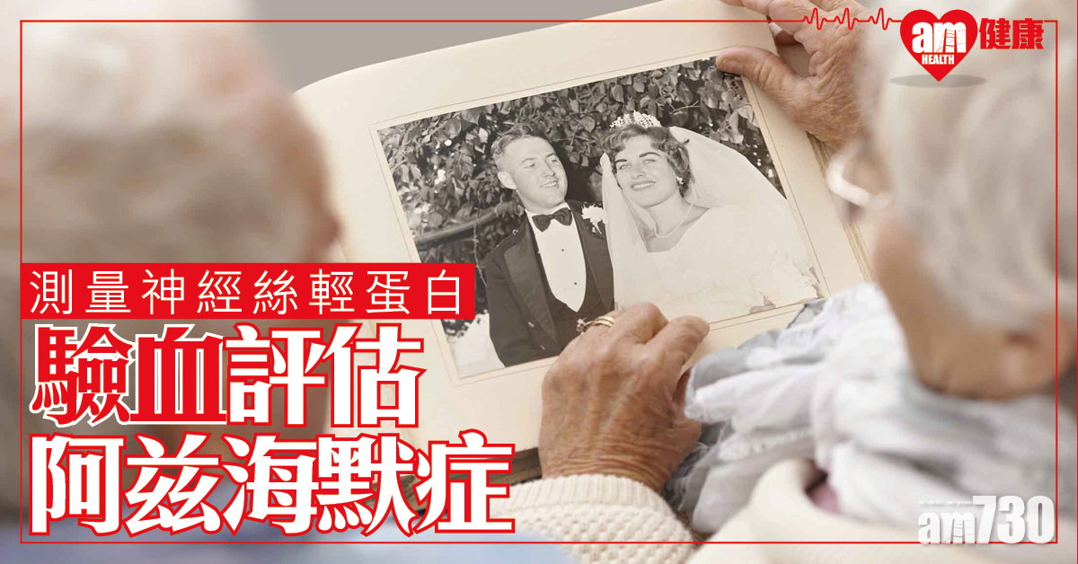 檢測神經絲輕蛋白 追蹤阿兹海默症發展