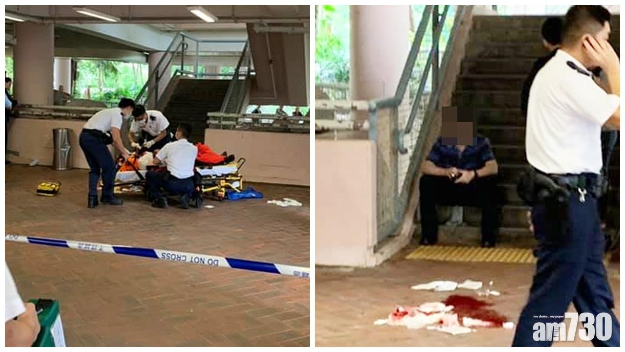 馬鞍山女子遭丈夫剪刀插臉浴血