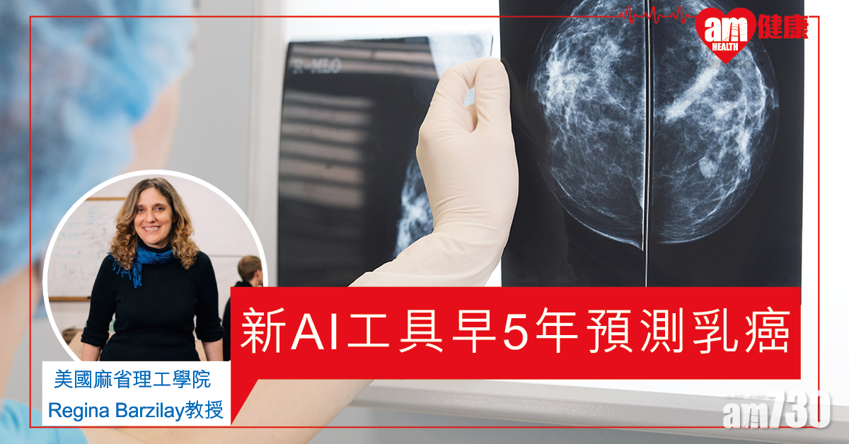 【智能檢測】麻省理工新AI工具 能提早5年預測乳癌風險