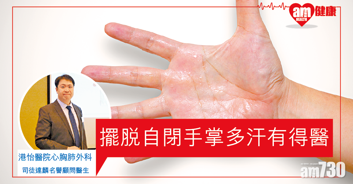 及早醫手掌多汗症 免引致社交恐懼