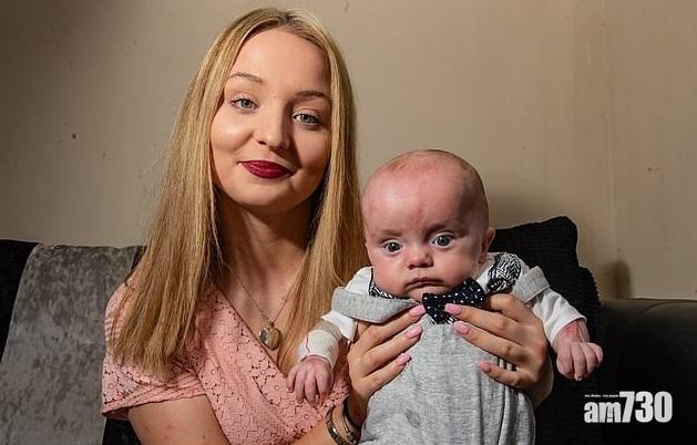 【生命力】無皮早產B似塊鮮肉  戰勝病魔堅強活下去