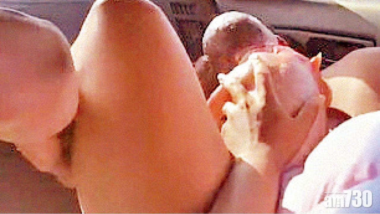 千萬網民見證 B女搶閘 狼狽分娩