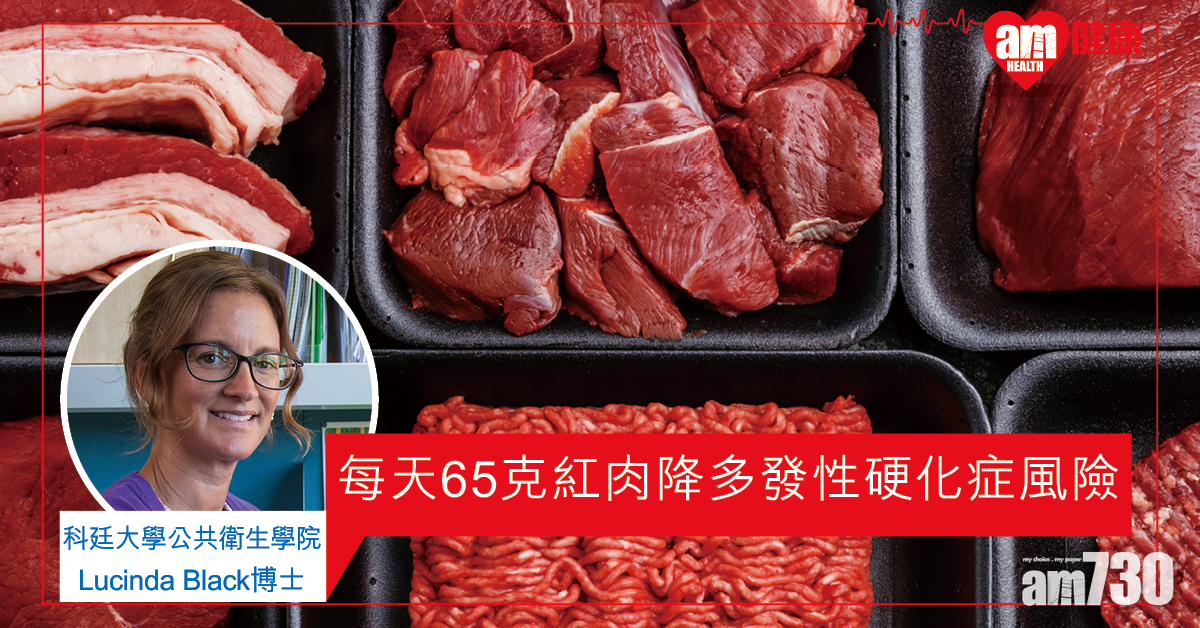 【紅肉有益】食用適量未加工紅肉 或可降多發性硬化症風險