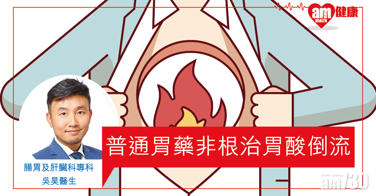 壓力大食無定時 易誘發胃酸倒流