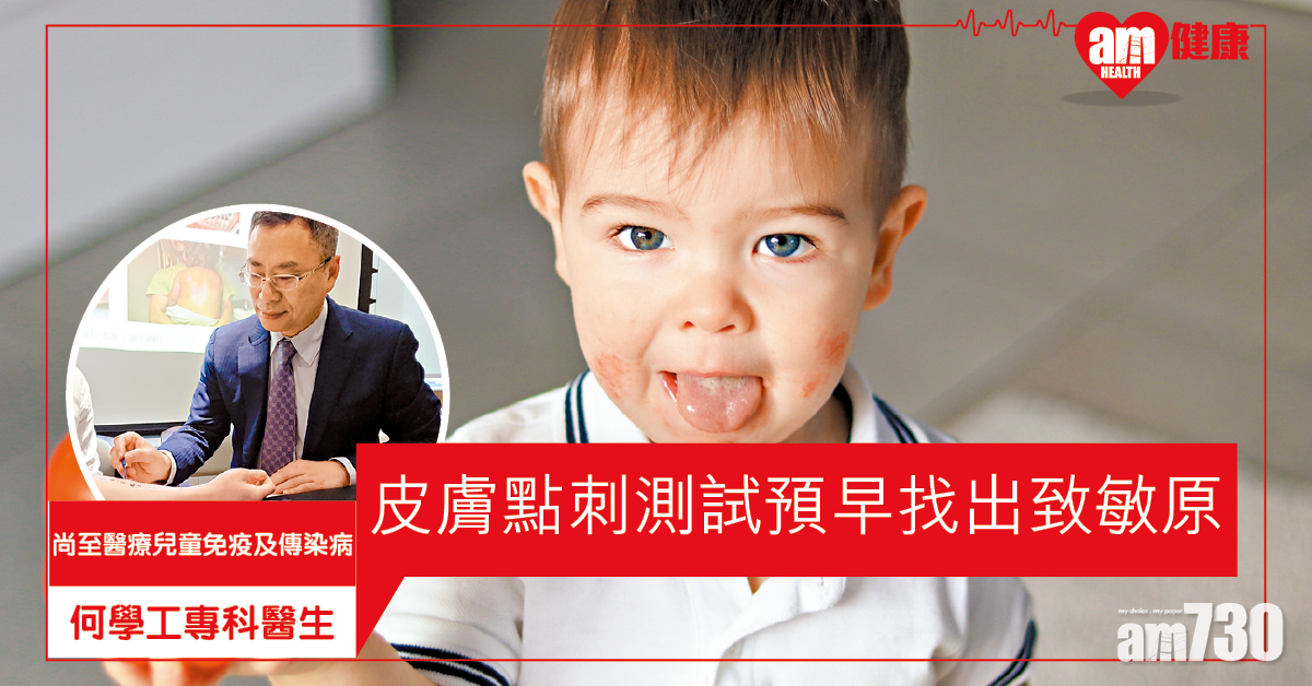 找出致敏原 預防過敏