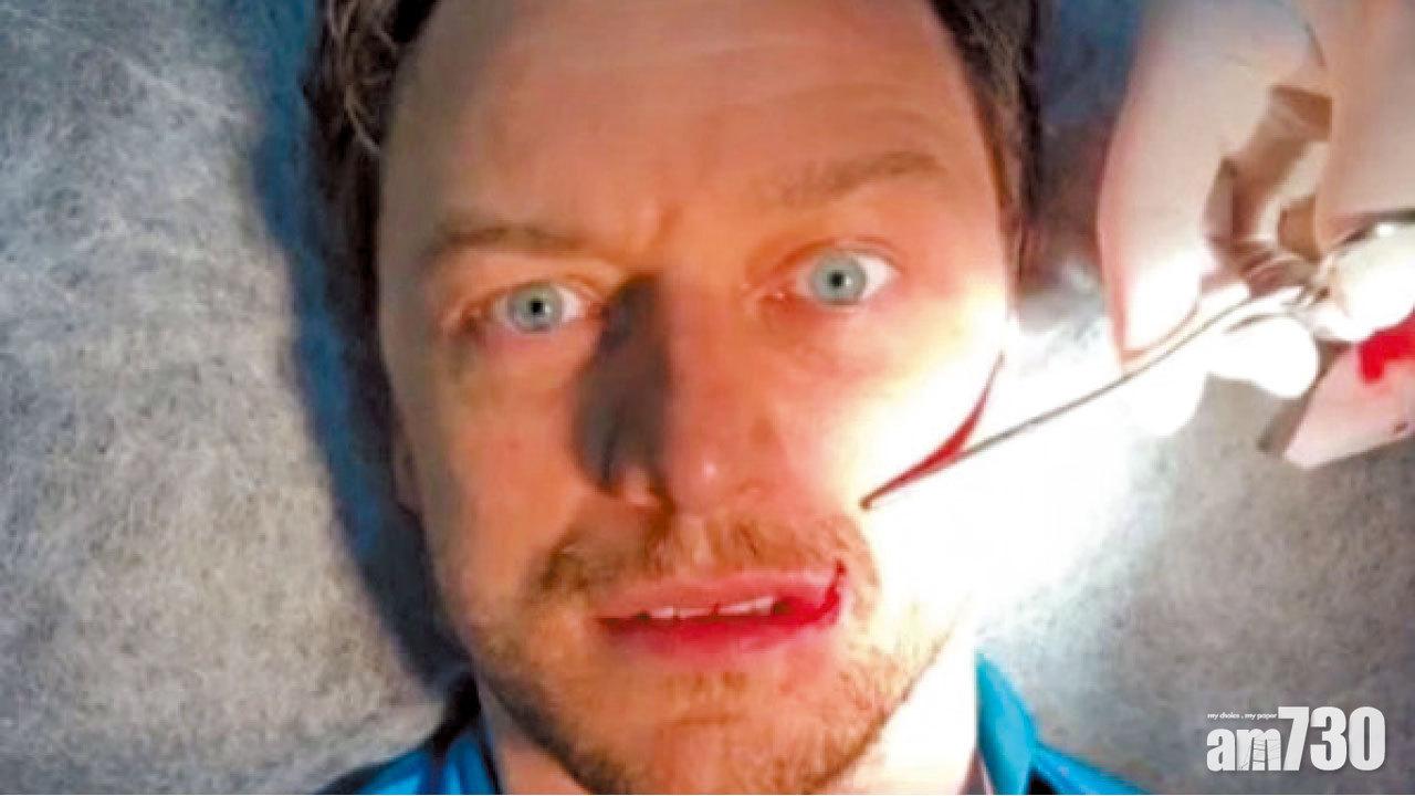 「X教授」占士麥艾禾 踢波爆嘴