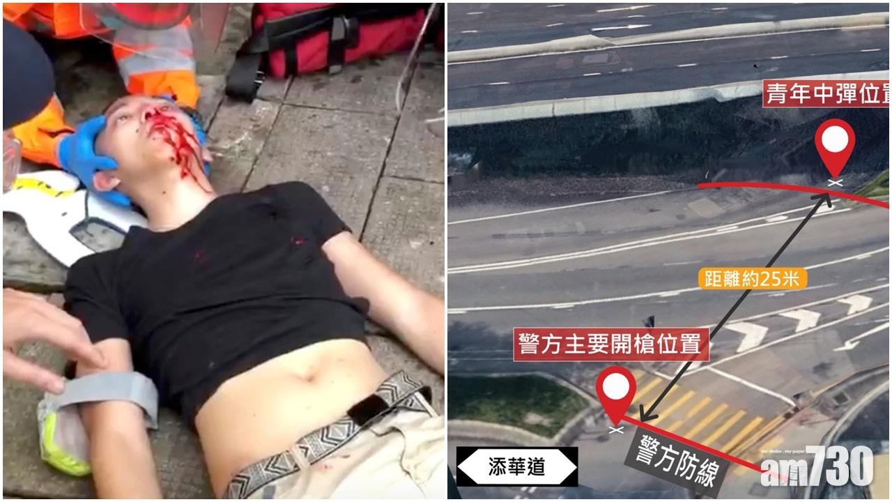 【金鐘衝突】傳真社：吐血青年報平安  無衝擊質疑被當靶