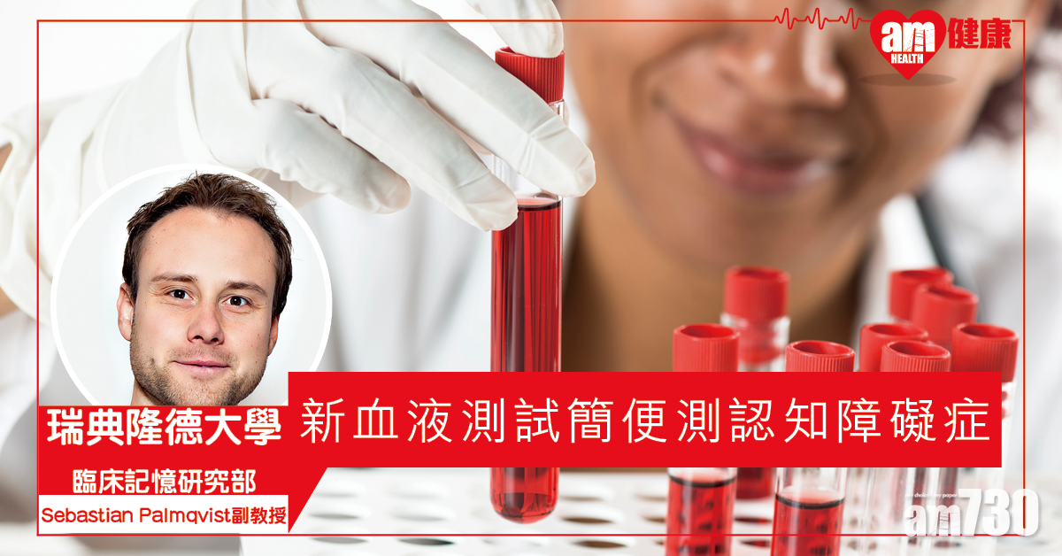 【阿茲海默症】瑞典研發新血液測試 準確識別蛋白異常積聚