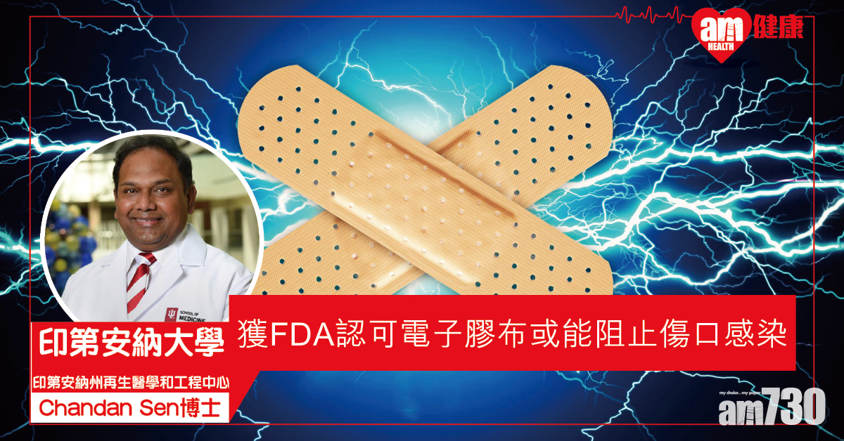 【電子膠布】獲FDA認可 一種敷料能釋出電場阻止傷口感染