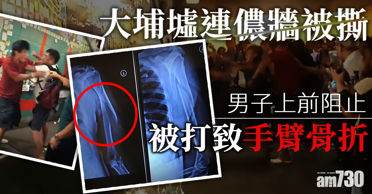 【連儂牆】大埔墟有市民起衝突  一名男子手臂骨折送院