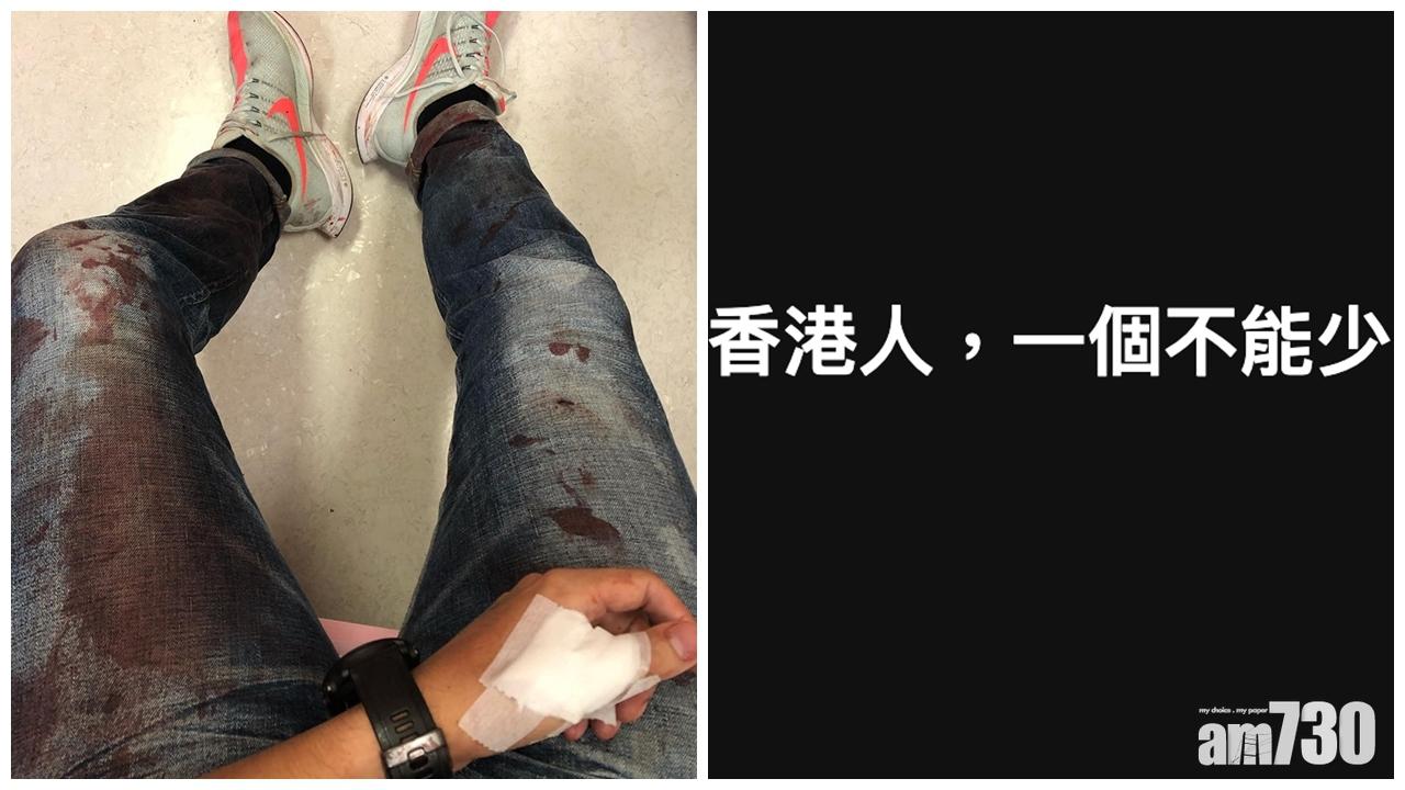 【元朗黑夜】柳俊江籲林鄭展現承擔　回應5大訴求