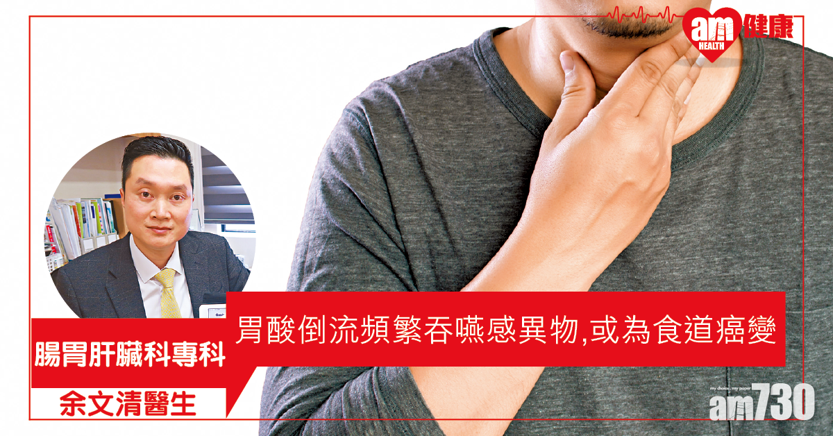 胃酸倒流及早醫 避免食道癌變