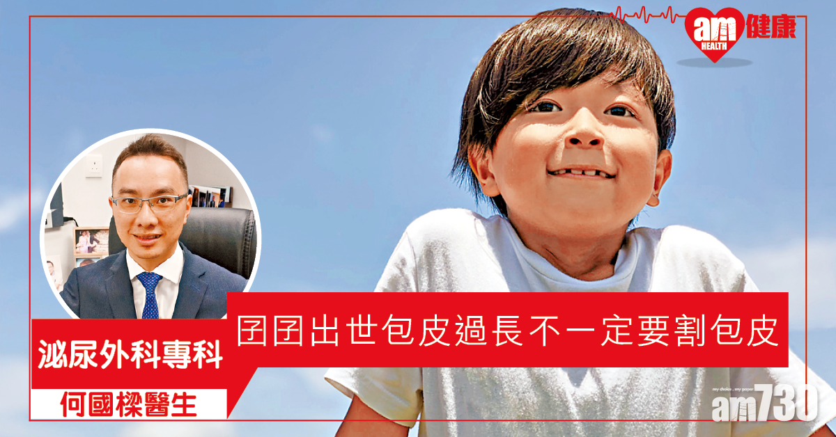 囝囝要割包皮嗎？