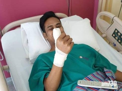 【切手指】手機屏幕保護貼碎裂 大馬男拇指