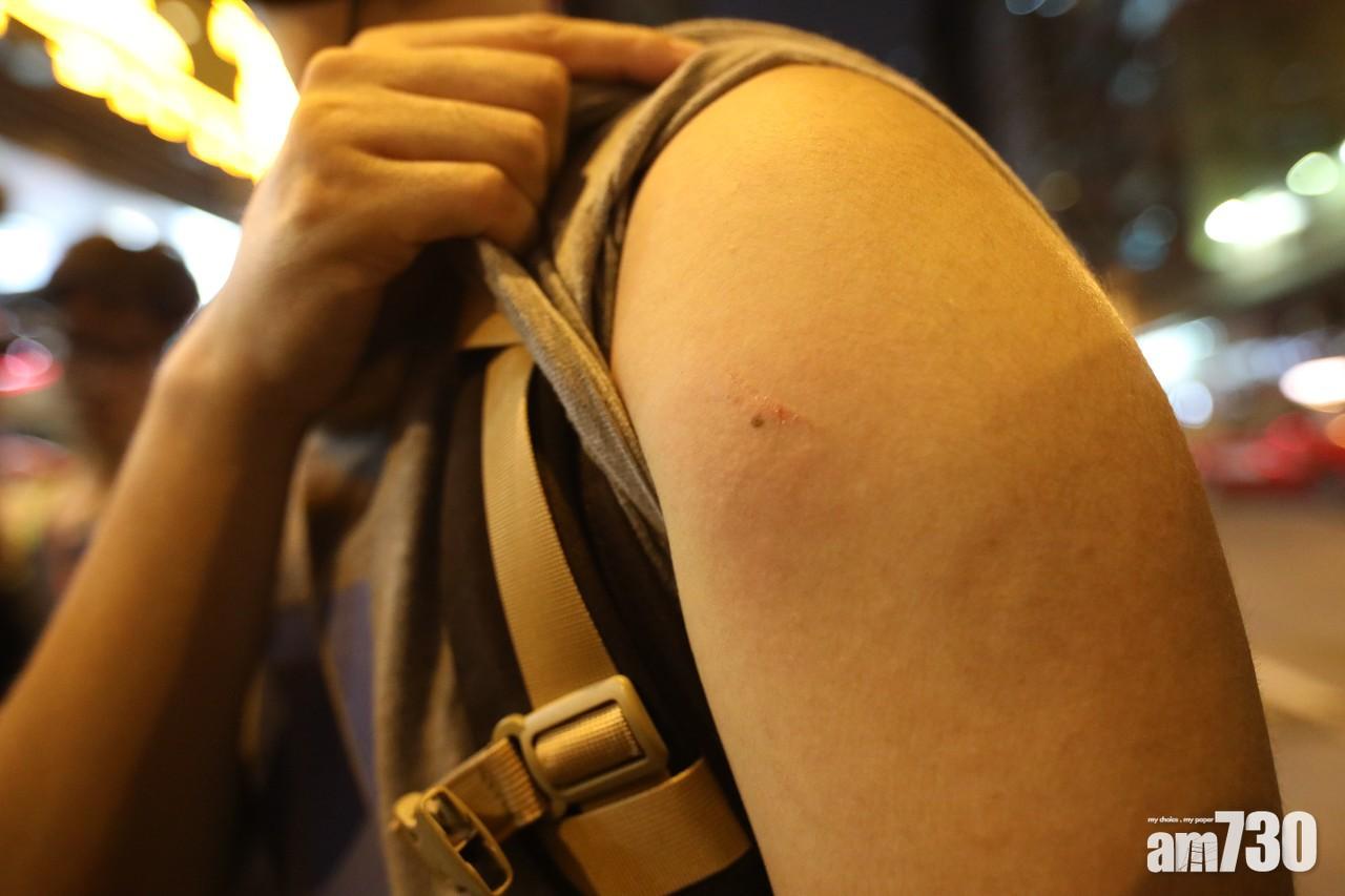 日內多宗記者遇襲個案 兩記者協會促警方交代