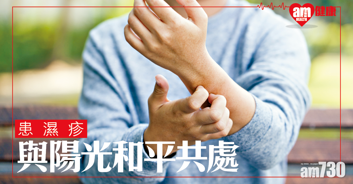 患濕疹 與陽光和平共處