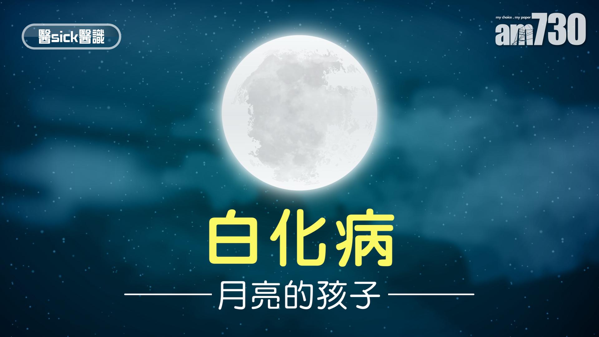 白化病 – 月亮的孩子