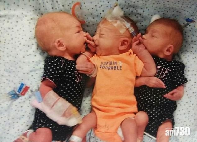 【神奇】以為生腎石  美婦全身痛到入院先知懷三胞胎