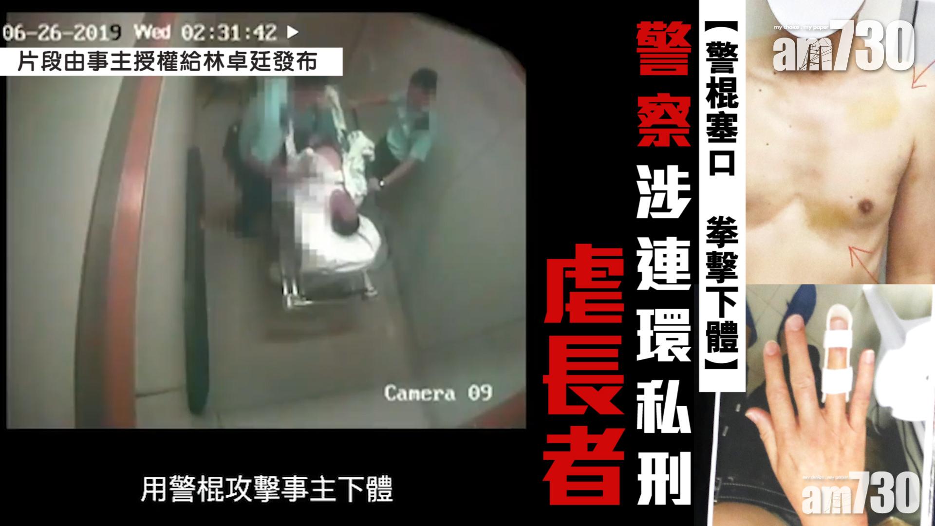 【警棍塞口 拳擊下體】警察涉連環私刑虐長者