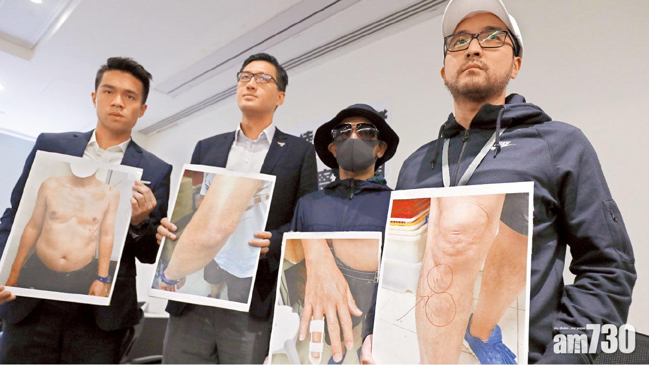 3警涉濫用私刑被捕 特別病房CCTV全紀錄