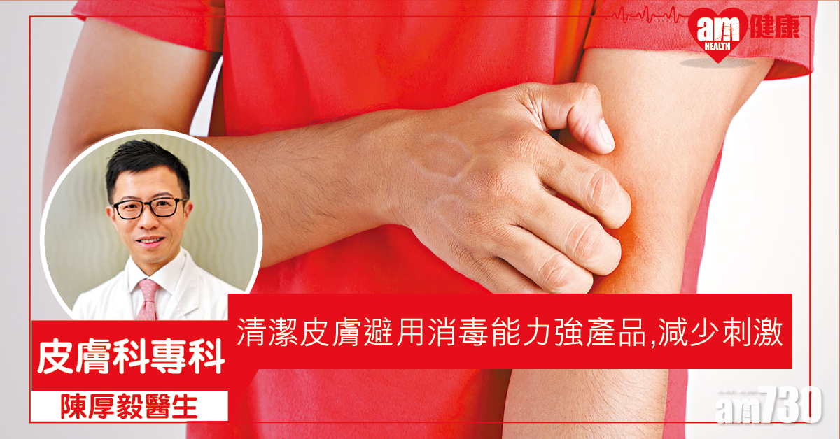 濕疹｜為何夏天易復發？細數濕疹成因