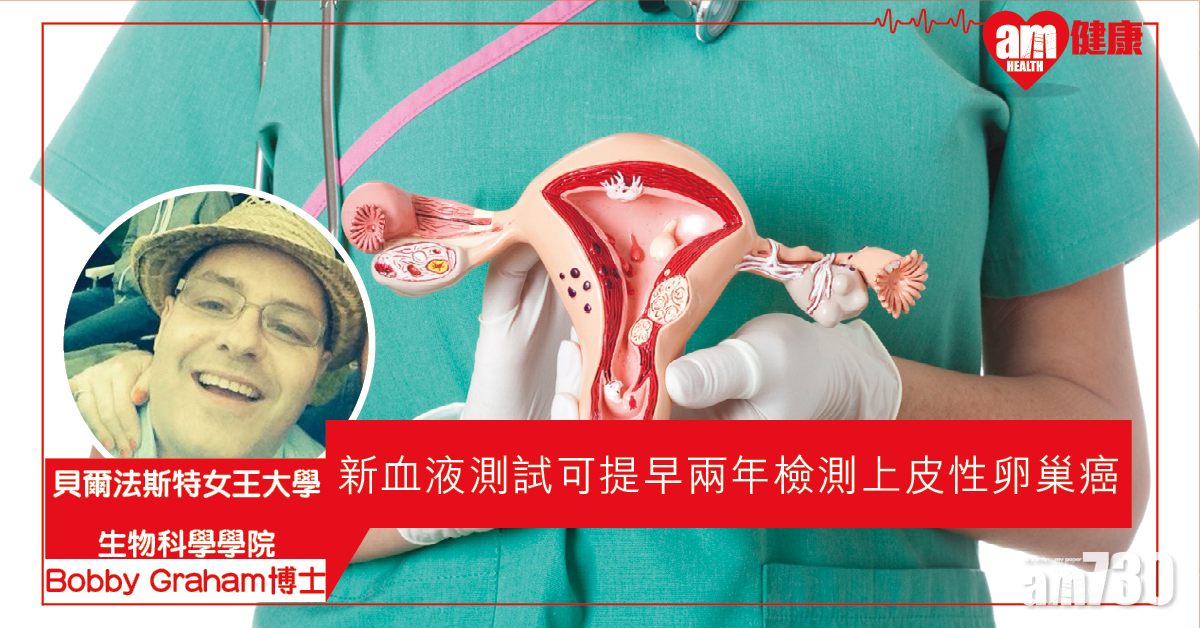 【提升存活率】 英研：新驗血法有助提早兩年驗出卵巢癌