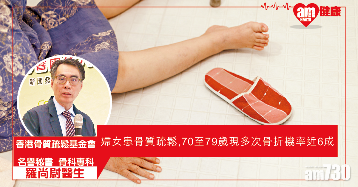 及早治療骨質疏鬆 避免連環骨折