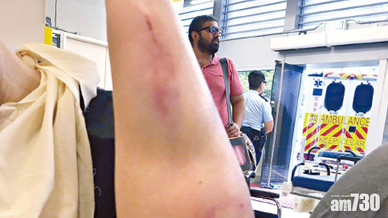 民陣岑子杰與友人遇襲  兇徒持鐵通壘球棍