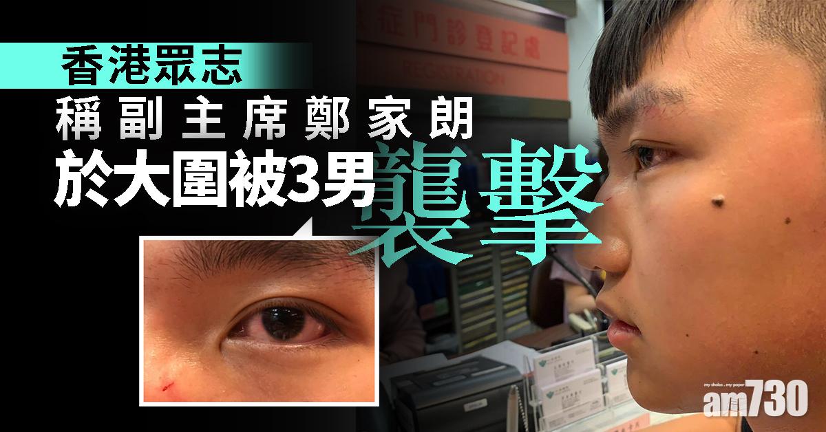 香港眾志：副主席鄭家朗在大圍被3男襲擊