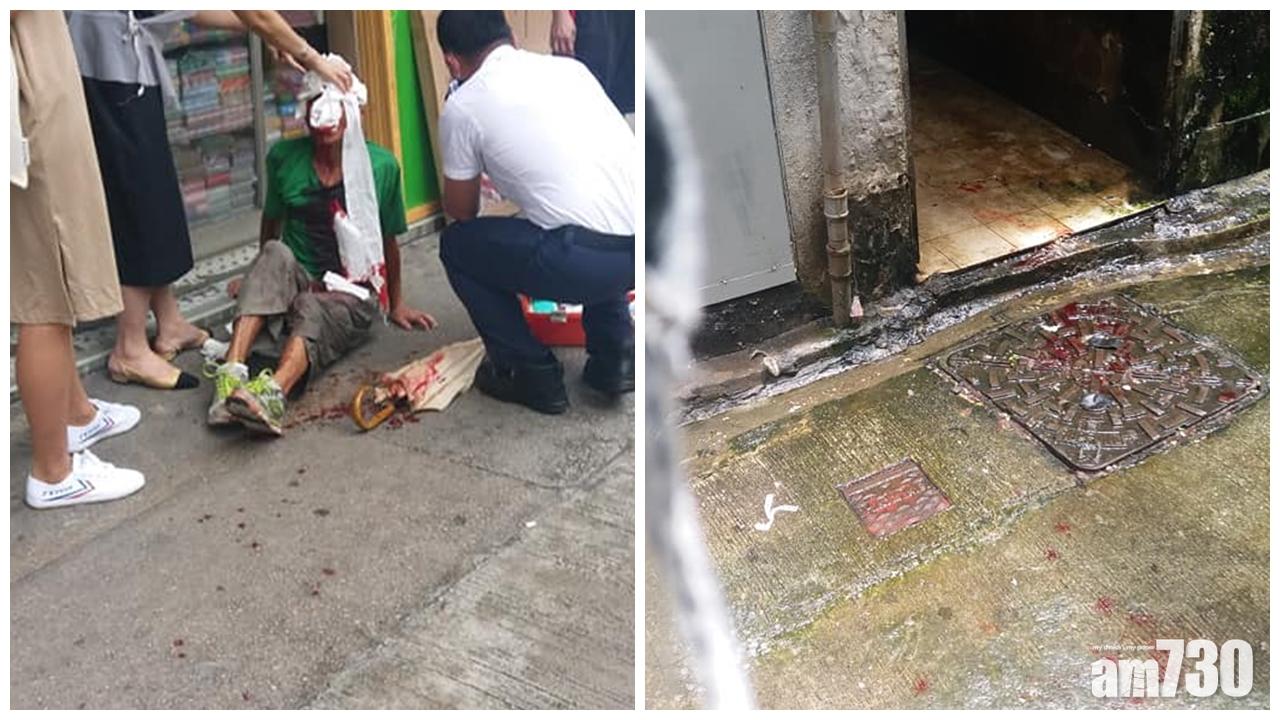 六旬外賣男遭扑頭搶手機金鏈　血流披面送院