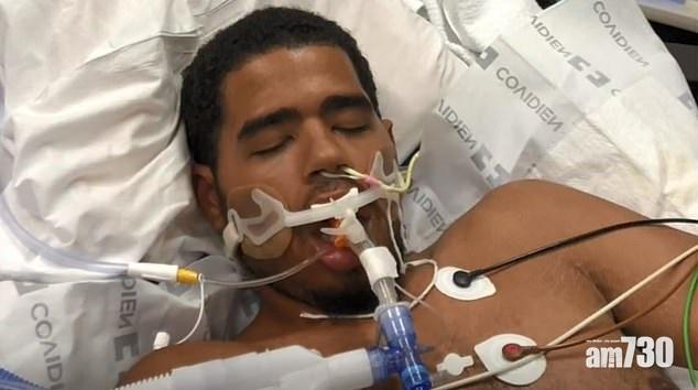 【第6宗死亡個案】美21歲大學生吸電子煙數年　健康突轉差肺衰竭亡