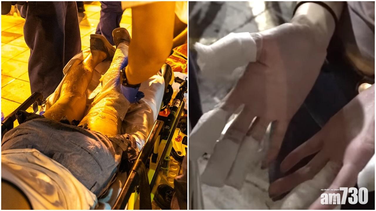 鴨脷洲邨狂徒擲腐液6人傷5人送院