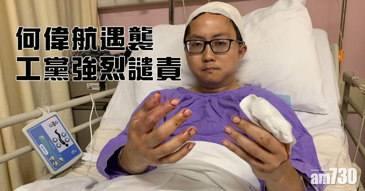 何偉航遇襲 工黨強烈䜋責