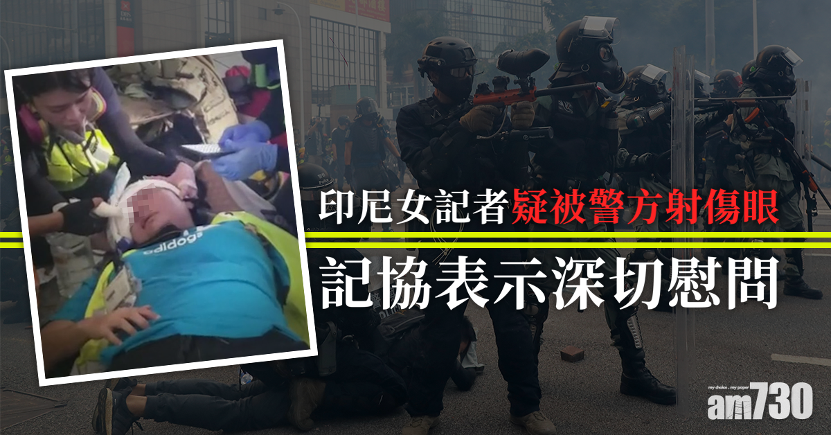 女記者疑被射傷眼　記協表深切慰問