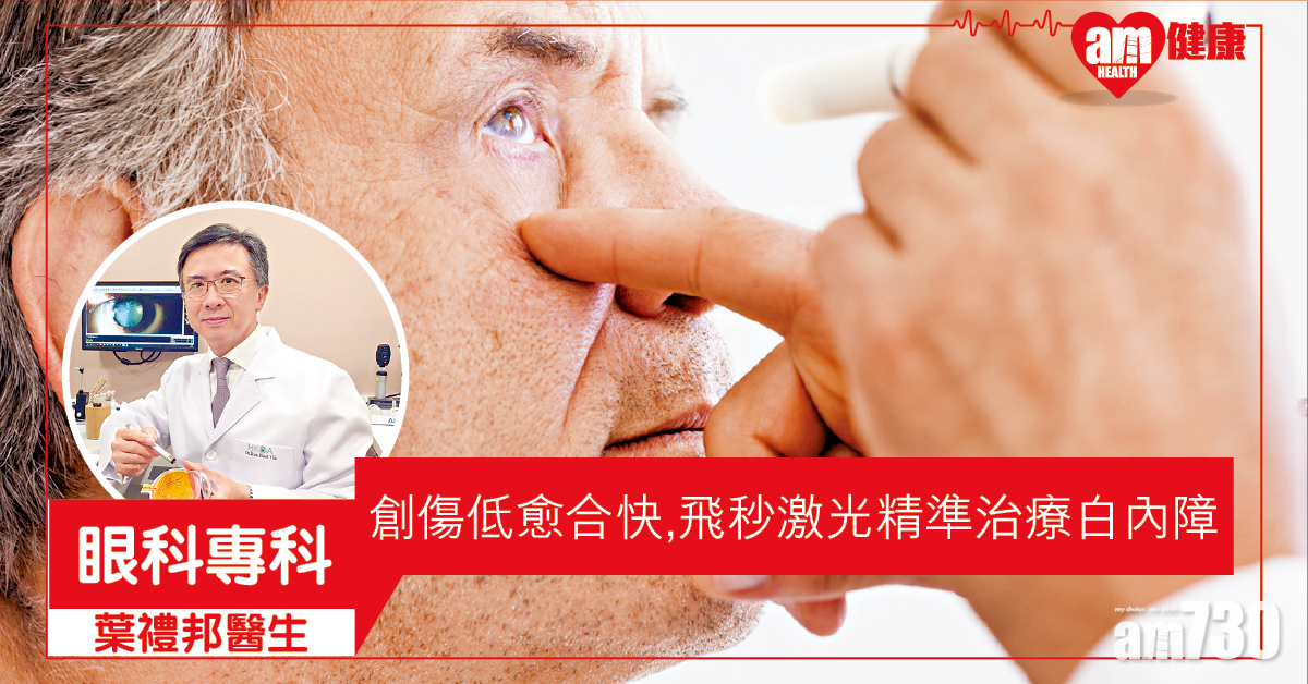 飛秒激光 精準治療白內障