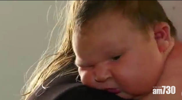 【未足月】女嬰重13磅  如迷你相撲手