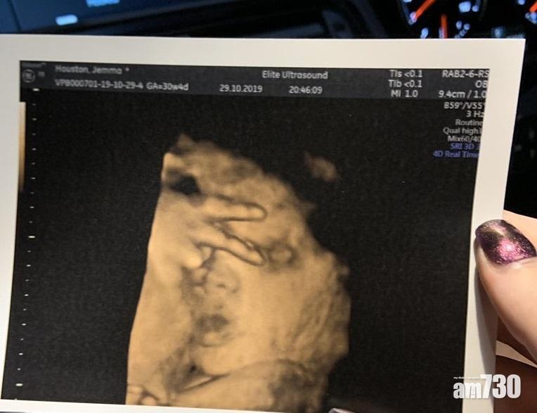 【未出世就玩嘢】腹中B女反V手勢遮面 準媽媽O晒咀