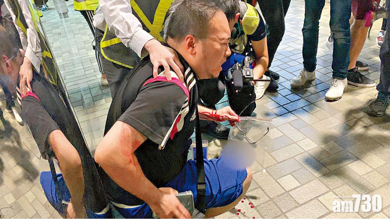 趙家賢耳朵駁回 行兇者疑有精神病紀錄